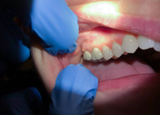 Best Weekend Emergency Dentist in Deridder, LA